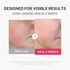 Mini Glow Skin Device
